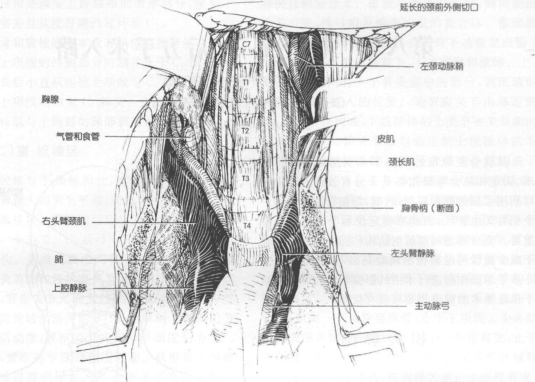 五、劈開(kāi)胸骨入路